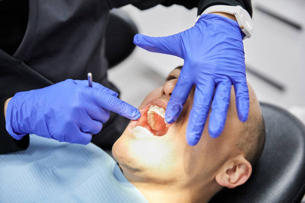 Best Emergency Treatment for Dental Infections or Abscesses in Utica, OH